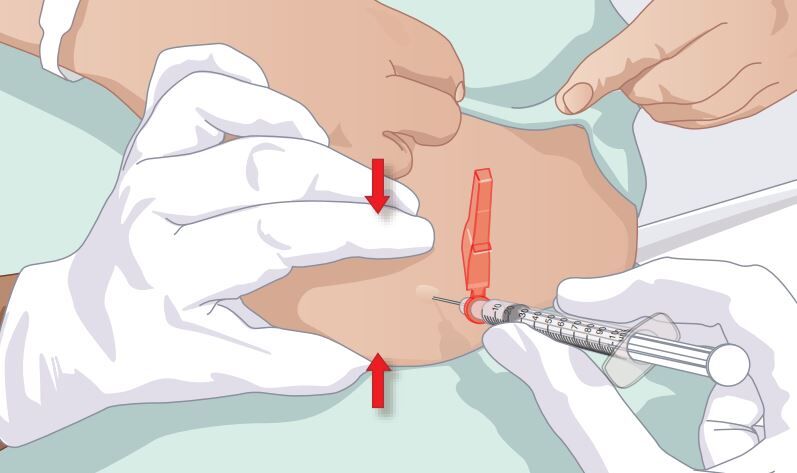 Injection Administration Training - Wren Healthcare - Clinical Skills